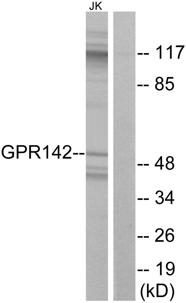 GPR142 Antibody - Western blot analysis of lysates from Jurkat cells, using GPR142 Antibody. The lane on the right is blocked with the synthesized peptide.