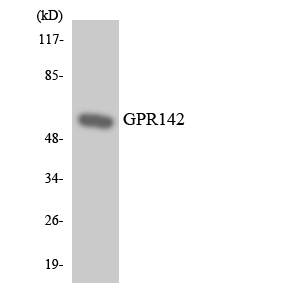 GPR142 Antibody - Western blot analysis of the lysates from HeLa cells using GPR142 antibody.