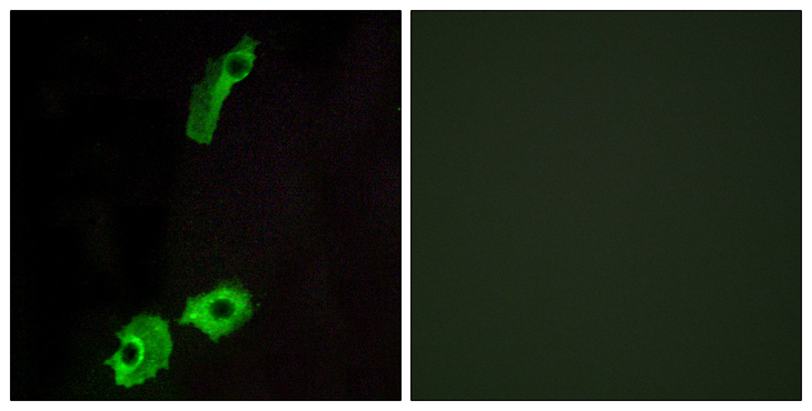 GPR151 Antibody - Immunofluorescence analysis of HeLa cells, using GPR151 Antibody. The picture on the right is blocked with the synthesized peptide.