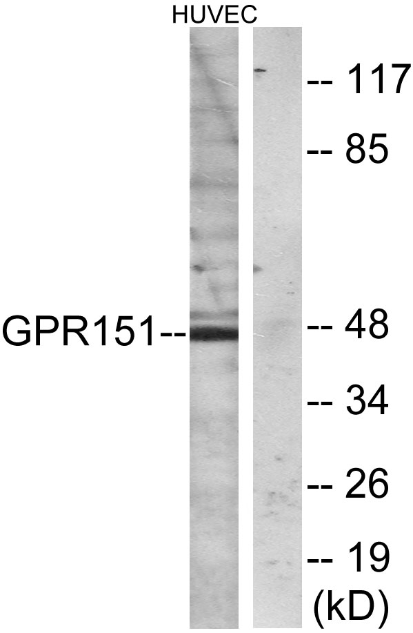 GPR151 Antibody - Western blot analysis of lysates from HUVEC cells, using GPR151 Antibody. The lane on the right is blocked with the synthesized peptide.
