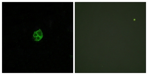 GPR151 Antibody - Immunofluorescence of HUVEC cells, using GPR151 Antibody. The picture on the right is treated with the synthesized peptide.