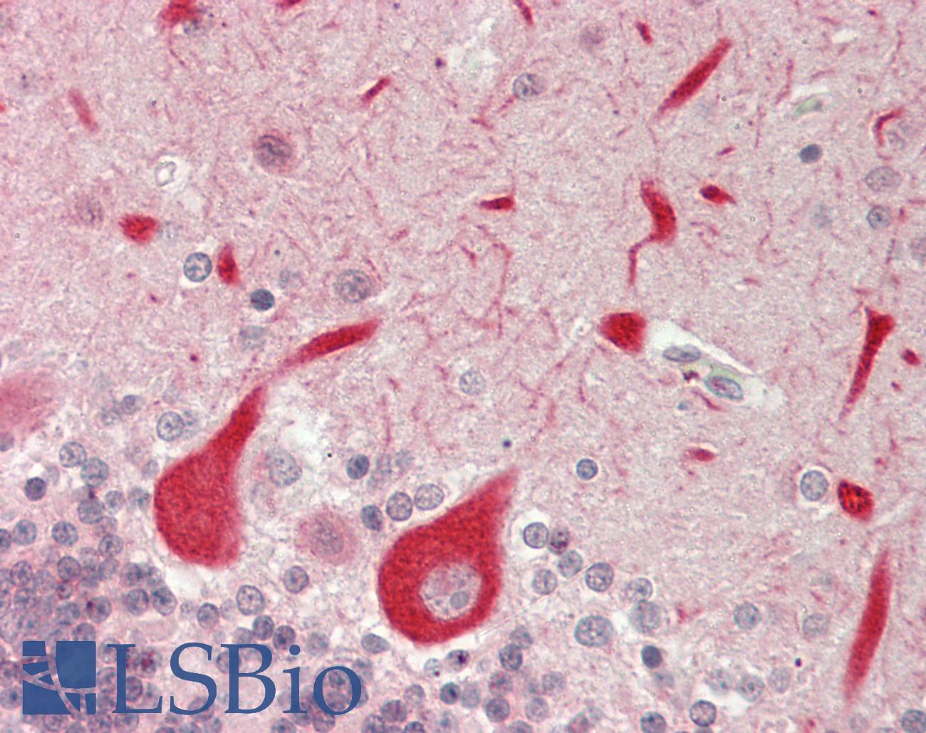GPR152 Antibody - Human Brain, Cerebellum: Formalin-Fixed, Paraffin-Embedded (FFPE)