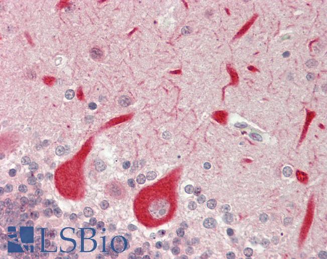 GPR152 Antibody - Human Brain, Cerebellum: Formalin-Fixed, Paraffin-Embedded (FFPE)