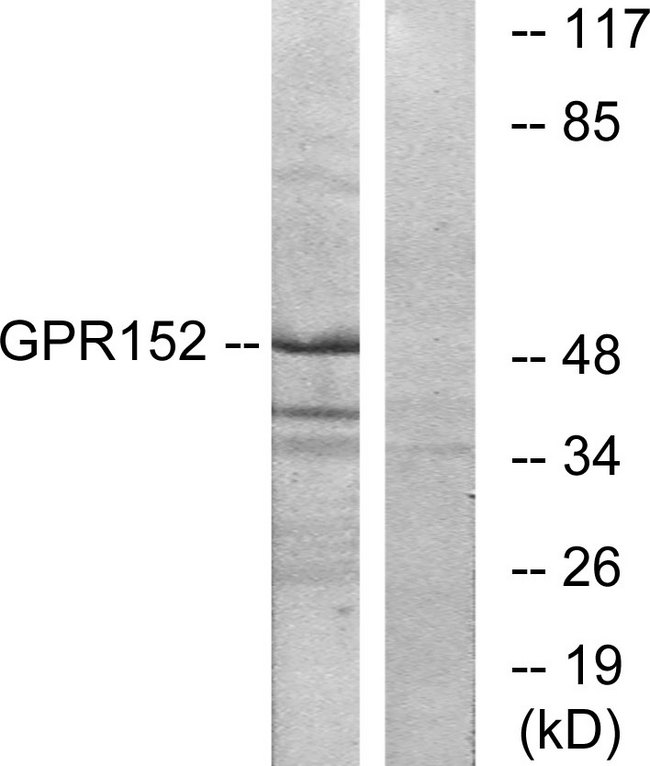 GPR152 Antibody - Western blot analysis of lysates from Jurkat cells, using GPR152 Antibody. The lane on the right is blocked with the synthesized peptide.