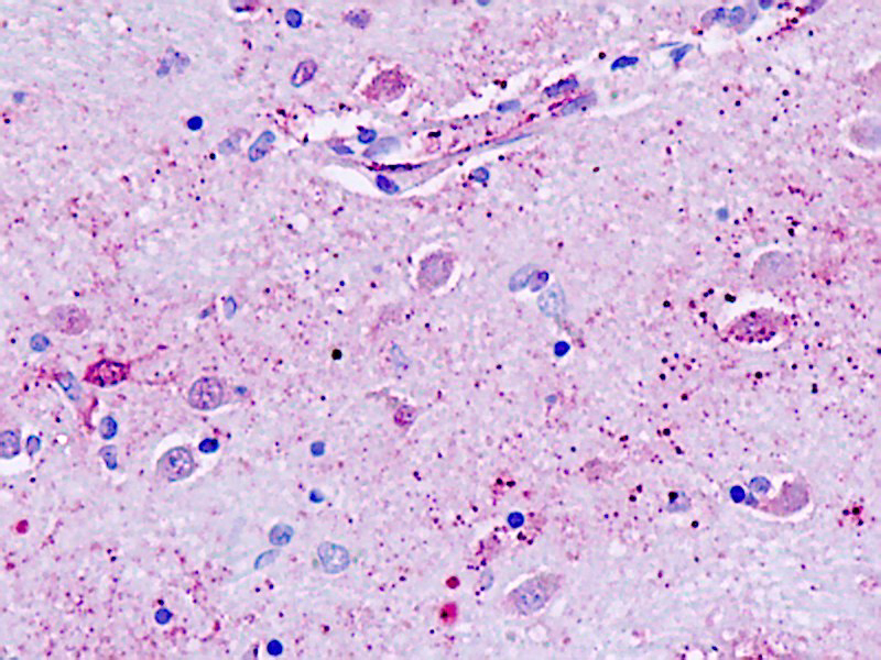 GPR162 Antibody - Human, Brain, neurons: Formalin-Fixed Paraffin-Embedded (FFPE)