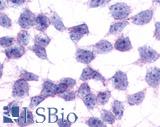 GPR17 Antibody - Anti-GPR17 antibody immunocytochemistry (ICC) staining of untransfected HEK293 human embryonic kidney cells.