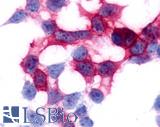 GPR17 Antibody - Anti-GPR17 antibody immunocytochemistry (ICC) staining of HEK293 human embryonic kidney cells transfected with GPR17.