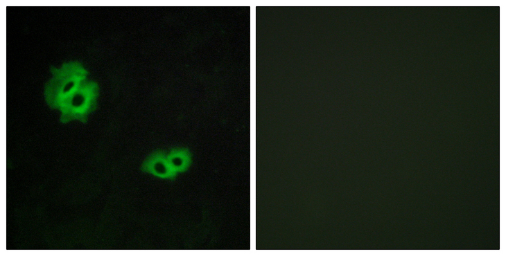 GPR171 Antibody - Immunofluorescence analysis of MCF7 cells, using GPR171 Antibody. The picture on the right is blocked with the synthesized peptide.
