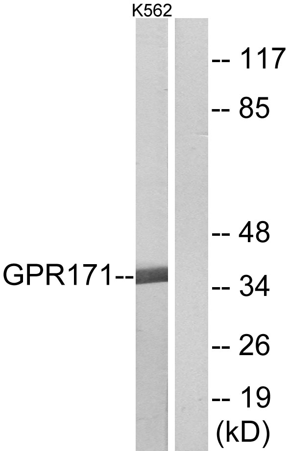 GPR171 Antibody - Western blot analysis of lysates from K562 cells, using GPR171 Antibody. The lane on the right is blocked with the synthesized peptide.