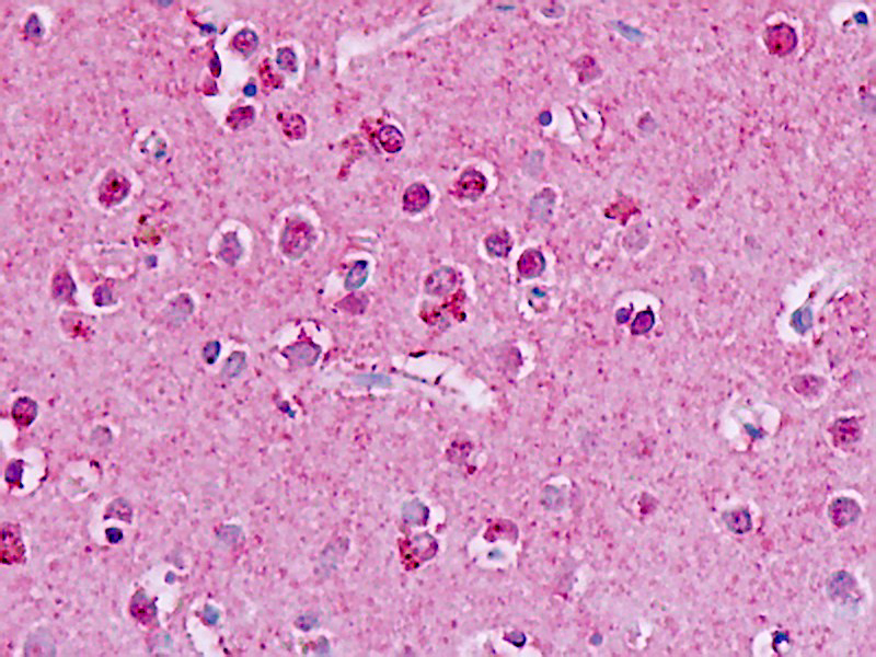GPR182 / ADMR Antibody - Human, Brain, neurons: Formalin-Fixed Paraffin-Embedded (FFPE)