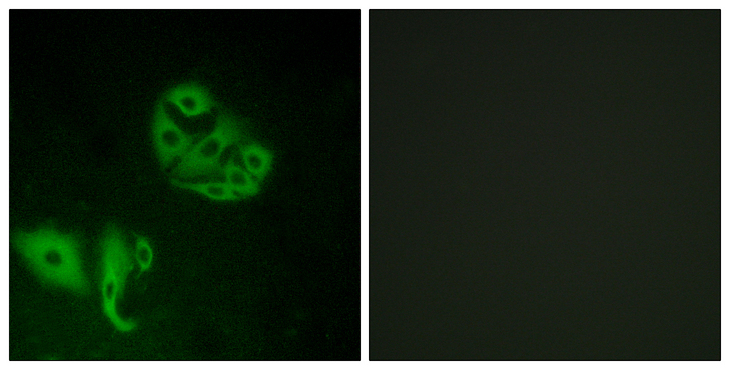 GPR20 Antibody - Immunofluorescence analysis of A549 cells, using GPR20 Antibody. The picture on the right is blocked with the synthesized peptide.