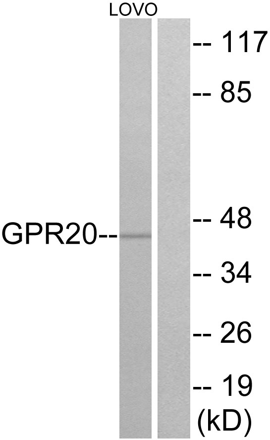 GPR20 Antibody - Western blot analysis of lysates from LOVO cells, using GPR20 Antibody. The lane on the right is blocked with the synthesized peptide.