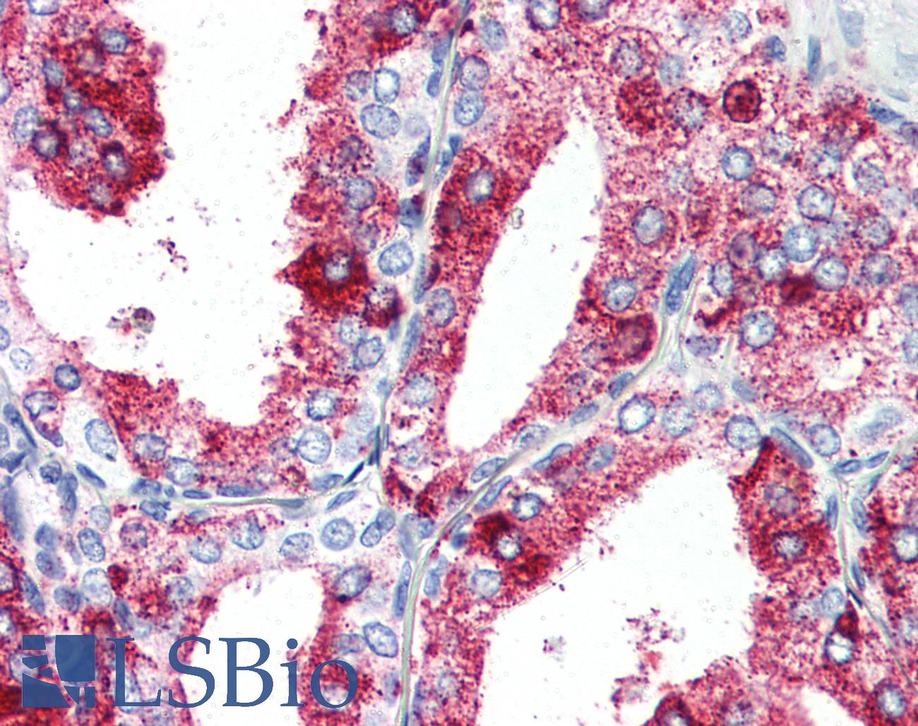 GPR27 Antibody - Anti-GPR27 antibody IHC of human prostate. Immunohistochemistry of formalin-fixed, paraffin-embedded tissue after heat-induced antigen retrieval.