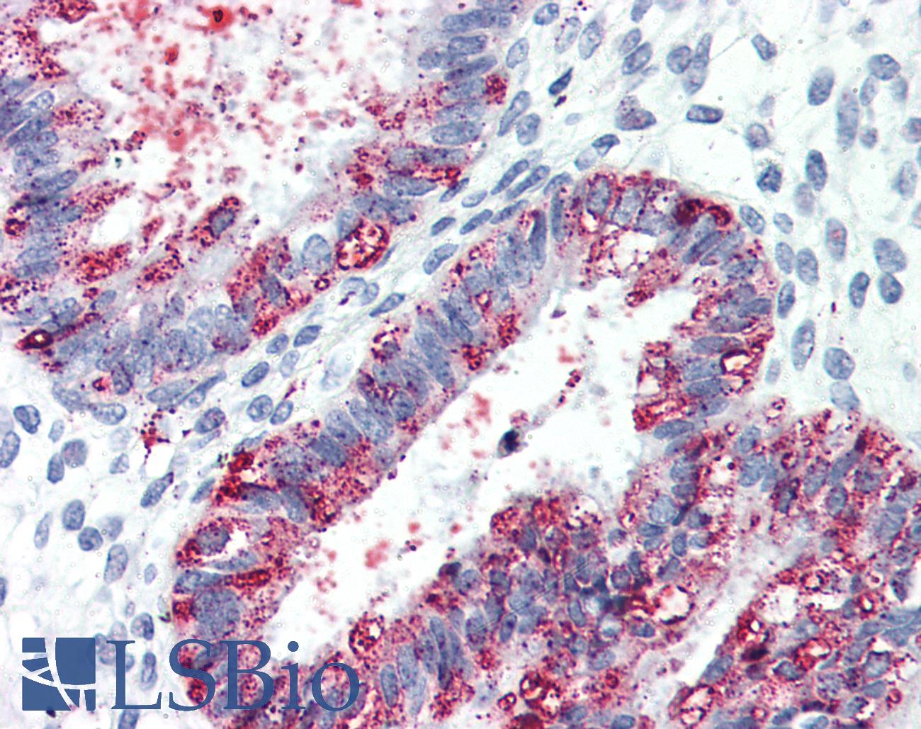 GPR27 Antibody - Anti-GPR27 antibody IHC of human uterus. Immunohistochemistry of formalin-fixed, paraffin-embedded tissue after heat-induced antigen retrieval.