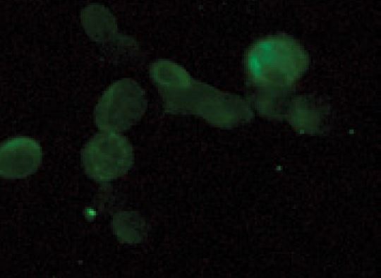 GPR31 Antibody - Immunofluorescent staining of PC3 cells with GPR31 antibody (1:100).
