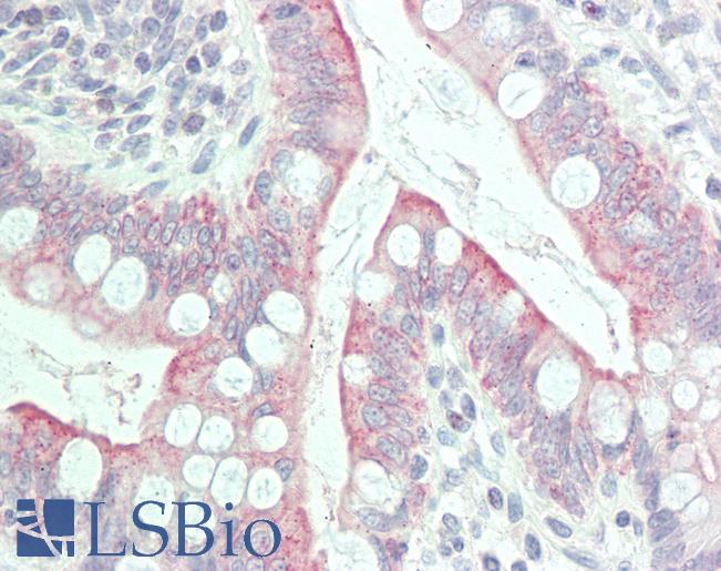 GPR31 Antibody - Anti-GPR31 antibody IHC staining of human small intestine. Immunohistochemistry of formalin-fixed, paraffin-embedded tissue after heat-induced antigen retrieval.