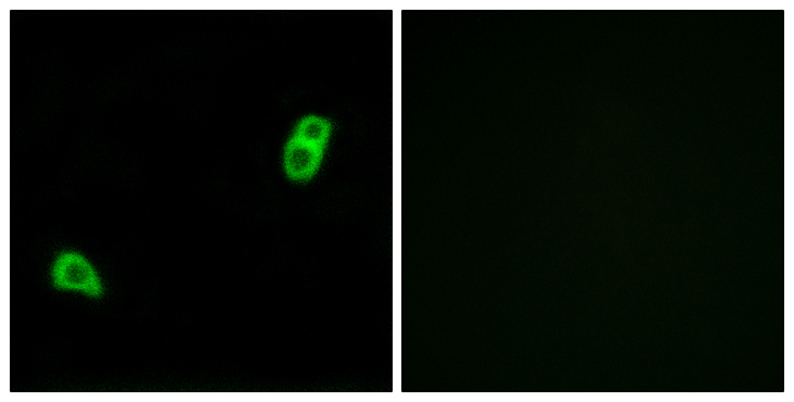 GPR34 Antibody - Immunofluorescence analysis of LOVO cells, using GPR34 Antibody. The picture on the right is blocked with the synthesized peptide.