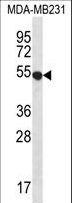 GPR34 Antibody - GPR34 Antibody western blot of MDA-MB231 cell line lysates (35 ug/lane). The GPR34 antibody detected the GPR34 protein (arrow).
