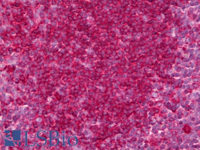 GPR35 Antibody - Anti-GPR35 antibody IHC of human tonsil. Immunohistochemistry of formalin-fixed, paraffin-embedded tissue after heat-induced antigen retrieval. Antibody concentration 5 ug/ml.