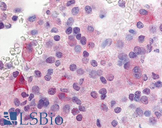 GPR37L1 Antibody - Anti-GPR37L1 antibody IHC of human anterior pituitary. Immunohistochemistry of formalin-fixed, paraffin-embedded tissue after heat-induced antigen retrieval.