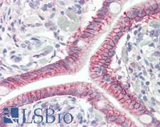GPR52 Antibody - Anti-GPR52 antibody IHC staining of human small intestine. Immunohistochemistry of formalin-fixed, paraffin-embedded tissue after heat-induced antigen retrieval.