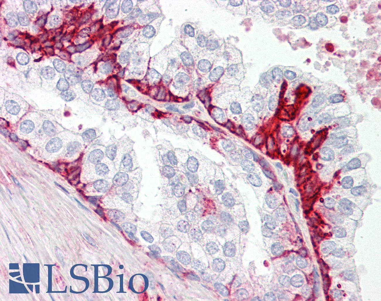 GPR55 Antibody - Anti-GPR55 antibody IHC staining of human prostate. Immunohistochemistry of formalin-fixed, paraffin-embedded tissue after heat-induced antigen retrieval.