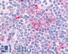 GPR62 Antibody - Anti-GPR62 antibody IHC of human tonsil. Immunohistochemistry of formalin-fixed, paraffin-embedded tissue after heat-induced antigen retrieval.