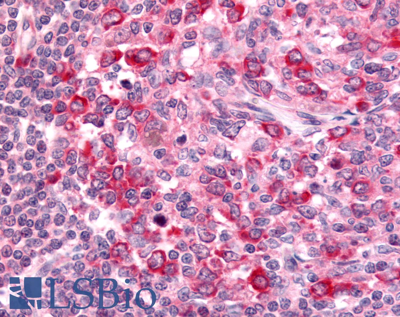 GPR65 / TDAG8 Antibody - Anti-GPR65 antibody IHC of human lymph node. Immunohistochemistry of formalin-fixed, paraffin-embedded tissue after heat-induced antigen retrieval.