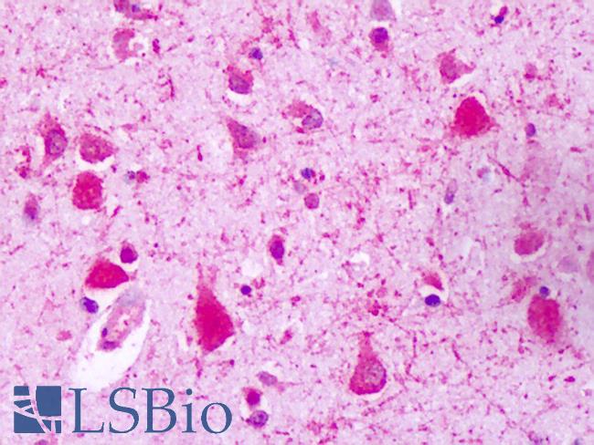 GPRC5A / RAI3 Antibody - Anti-GPRC5A / RAI3 antibody IHC of human brain, neurons. Immunohistochemistry of formalin-fixed, paraffin-embedded tissue after heat-induced antigen retrieval. Antibody dilution 4-10 ug/ml.