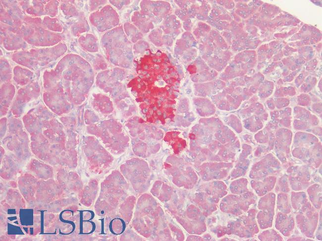 GPRC5D Antibody - Human Pancreas, Islets: Formalin-Fixed, Paraffin-Embedded (FFPE)