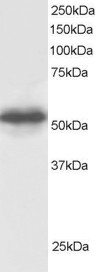 GPS1 / CSN1 Antibody - GPS1 / CSN1 antibody staining (0.5µg/ml) of Human Testis lysate (RIPA buffer, 30µg total protein per lane). Detected by chemiluminescence.