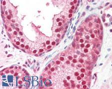 GPS1 / CSN1 Antibody - Human Prostate: Formalin-Fixed, Paraffin-Embedded (FFPE)