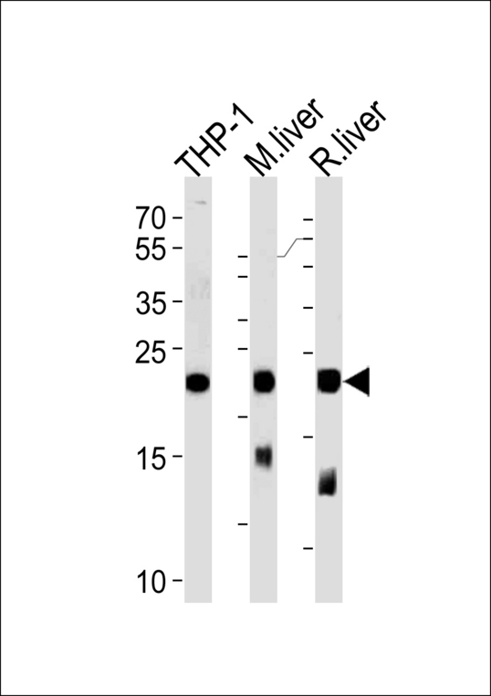 GPX1 / Glutathione Peroxidase Antibody - Western blot of lysates from THP-1 cell line, mouse liver and rat liver tissue (from left to right),using GPX1 Antibody. Antibody was diluted at 1:1000 at each lane. A goat anti-rabbit IgG H&L (HRP) at 1:5000 dilution was used as the secondary antibody.Lysates at 35ug per lane.