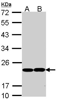 GPX1 / Glutathione Peroxidase Antibody - Sample (30 ug of whole cell lysate). A: Molt-4. B: Raji. 12% SDS PAGE. GPX1 antibody diluted at 1:1000. 