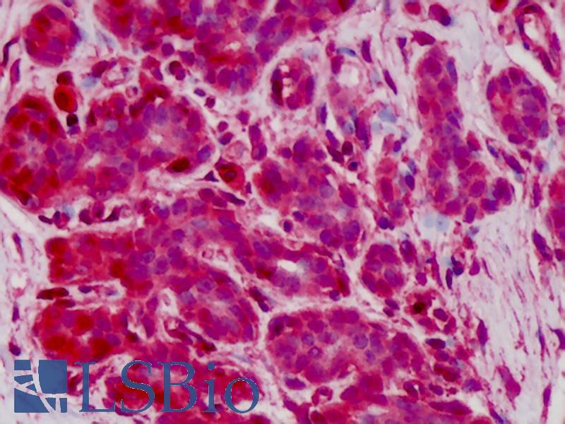 GPX1 / Glutathione Peroxidase Antibody - Anti-GPX1 antibody IHC of human breast. Immunohistochemistry of formalin-fixed, paraffin-embedded tissue after heat-induced antigen retrieval. Antibody concentration 10 ug/ml.