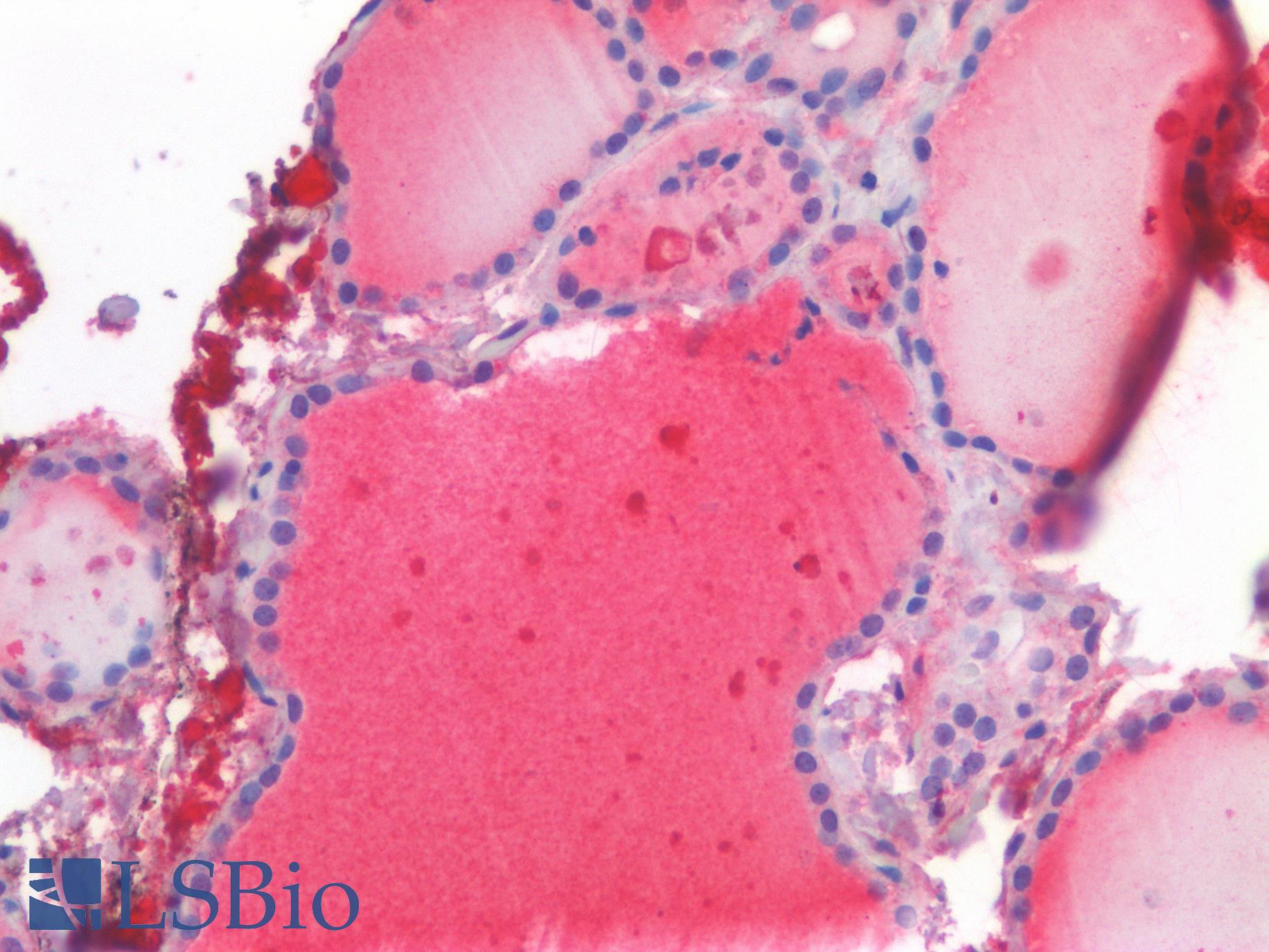 GPX3 Antibody - Human Thyroid: Formalin-Fixed, Paraffin-Embedded (FFPE)