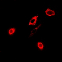 GPX4 / MCSP Antibody - Immunofluorescent analysis of GPx-4 staining in A549 cells. Formalin-fixed cells were permeabilized with 0.1% Triton X-100 in TBS for 5-10 minutes and blocked with 3% BSA-PBS for 30 minutes at room temperature. Cells were probed with the primary antibody in 3% BSA-PBS and incubated overnight at 4 deg C in a humidified chamber. Cells were washed with PBST and incubated with a DyLight 594-conjugated secondary antibody (red) in PBS at room temperature in the dark.