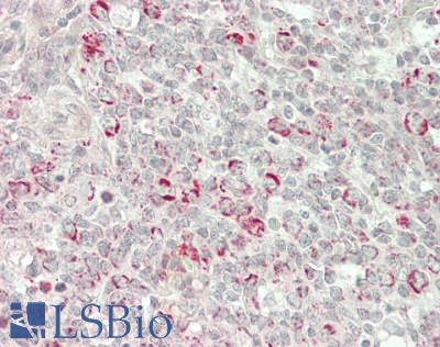 GPX4 / MCSP Antibody - Human Tonsil: Formalin-Fixed, Paraffin-Embedded (FFPE)