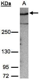 Gravin / AKAP12 Antibody - Sample (30g whole cell lysate). A: HeLa S3. 5% SDS PAGE. Gravin / AKAP12 antibody diluted at 1:1000