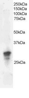GRB2 Antibody - Staining (2 ug/ml) of Jurkat lysate (RIPA buffer, 35 ug total protein per lane). Primary incubated for 1 hour. Detected using chemiluminescence.