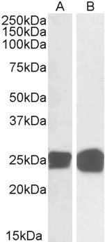 GRB2 Antibody - Goat Anti-GRB2 Antibody (0.05µg/ml) staining of Human Thymus (A) and MOLT4 (B) lysates (35µg total protein in RIPA buffer). Primary incubated for 1 hour. Detected by chemiluminescencence.