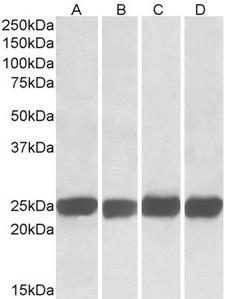 GRB2 Antibody - Goat Anti-GRB2 Antibody (0.05µg/ml) staining of Mouse (A+C) and Rat (B+D) Brain (A+B) and Spleen (C+D) lysates (35µg total protein in RIPA buffer). Primary incubated for 1 hour. Detected by western blot using chemiluminescence.