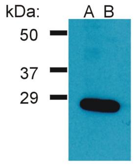 GRB2 Antibody - Western Blotting analysis (reducing conditions) of Ramos cell lysate using two batches of rabbit anti-Grb2 polyclonal (A, B).