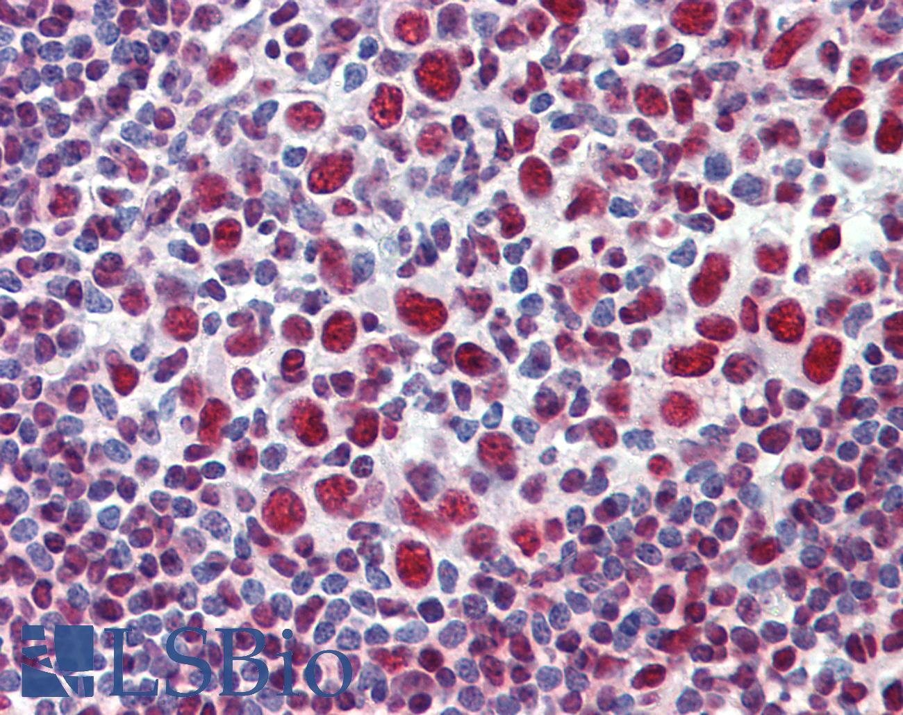 GRB2 Antibody - Anti-GRB2 antibody IHC of human tonsil. Immunohistochemistry of formalin-fixed, paraffin-embedded tissue after heat-induced antigen retrieval. Antibody concentration 10 ug/ml.