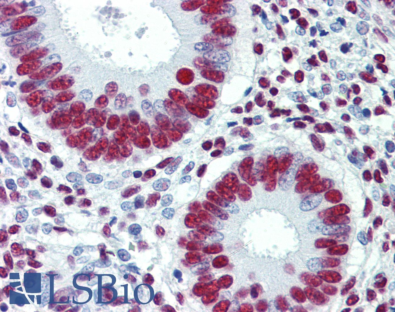 GRB2 Antibody - Anti-GRB2 antibody IHC of human uterus. Immunohistochemistry of formalin-fixed, paraffin-embedded tissue after heat-induced antigen retrieval. Antibody concentration 10 ug/ml.