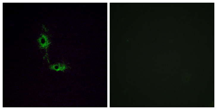 GRIA1 / GLUR1 Antibody - Immunofluorescence analysis of HeLa cells, using GluR1 Antibody. The picture on the right is blocked with the synthesized peptide.