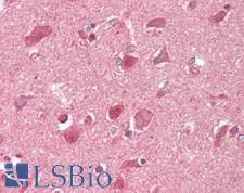 GRID1 Antibody - Human Brain, Cortex: Formalin-Fixed, Paraffin-Embedded (FFPE)