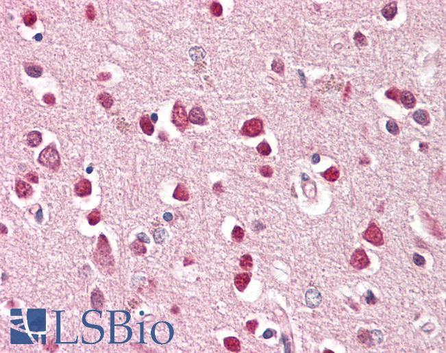 GRIK1 / GLUR5 Antibody - Anti-GRIK1 / GLUR5 antibody IHC of human brain, cortex. Immunohistochemistry of formalin-fixed, paraffin-embedded tissue after heat-induced antigen retrieval. Antibody dilution 3.75 ug/ml.