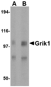 GRIK1 / GLUR5 Antibody - Western blot of Grik1 in rat brain tissue lysate with Grik1 antibody at (A) 0.5 and (B) 1 ug/ml.