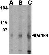 GRIK4 / KA1 Antibody - Western blot of Grik4 in rat brain lysate with Grik4 antibody at (A) 0.5 (B) 1 and (C) 2 ug/ml.